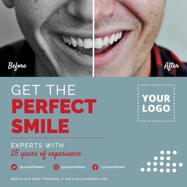 Edit a Before & After banner