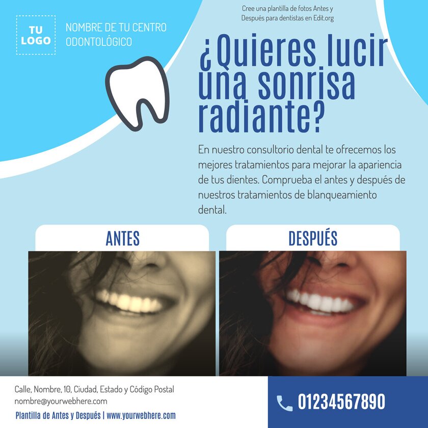 Plantilla de Antes y Después de dientes para dentistas