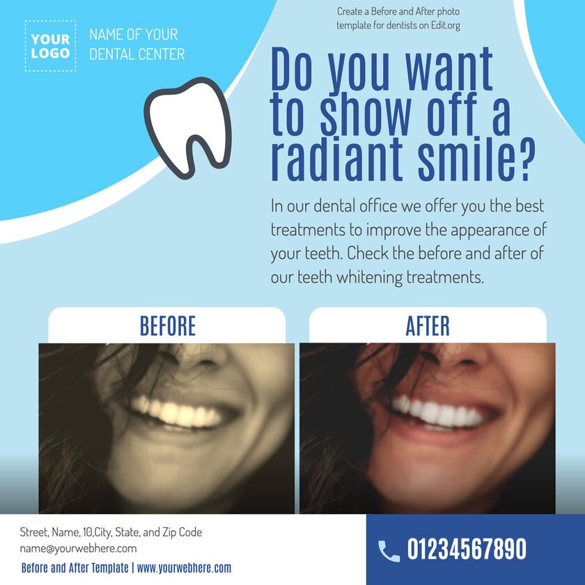 Make a before and after template free for dentists